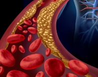 체내독소 중성지방/콜레스테롤