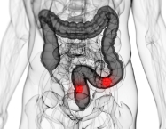 독소로 인해 나타나는 증상 장기능저하