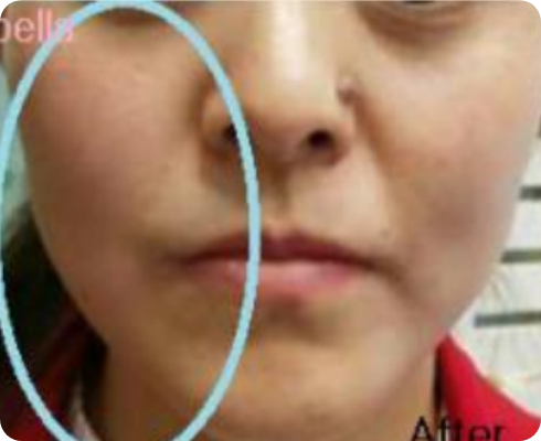 터치셀 
                            미세전류마사지기 20분 관리후 이미지